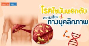 โรคไขมันพอกตับ