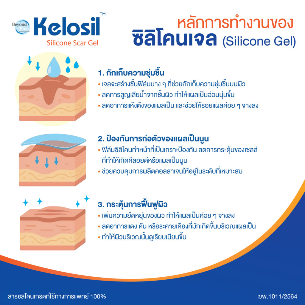 ยาลบรอยแผลเป็น Kelosil - Maxxlife